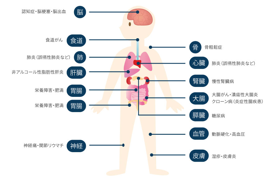 どんな病気が歯と関わっているの？